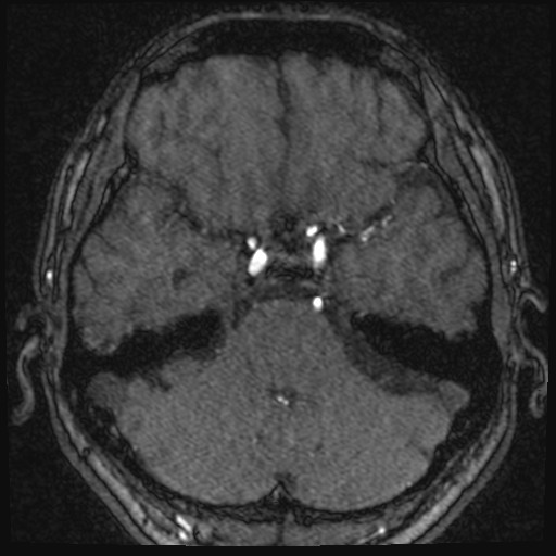 Click on the Serie image to view the images of VILLANUEVA, WILLIAM A.